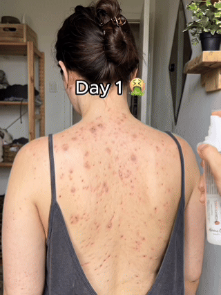 It's not dirty skin.